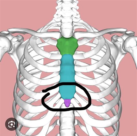 Xiphoid Process Lump