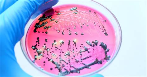 Molecular Microbiology | SGS India