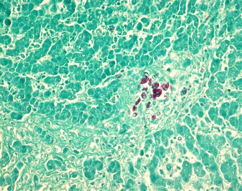 AFB staining kit for histology | 132450