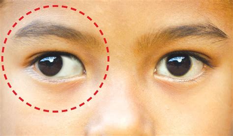 Tip menjaga kesihatan mata anak | Harian Metro