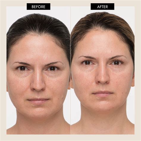 7E Myolift Mini Tutorial 的图像结果