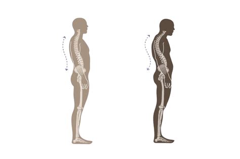 Different Types of Posture 的图像结果
