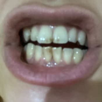 Image result for Sensodyne Toothpaste Review