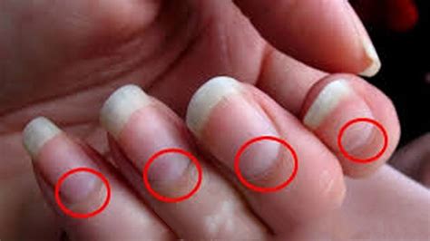 Bumpy Nails 的图像结果