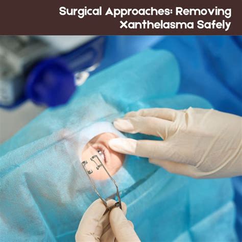 Xanthelasma: Causes, Treatment, and Prevention Tips | Clinikally