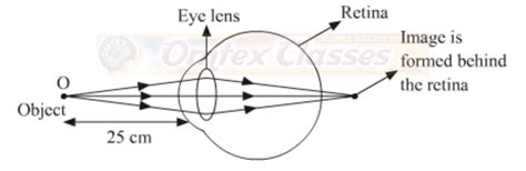 omtex.co.in : Science Chapter 7 - Lenses SSC, SCIENCE PART I, NEW ...