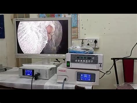 Addler Laparoscopic Endoscopic - 1288 HD Endoscope Laparoscopy Camera ...