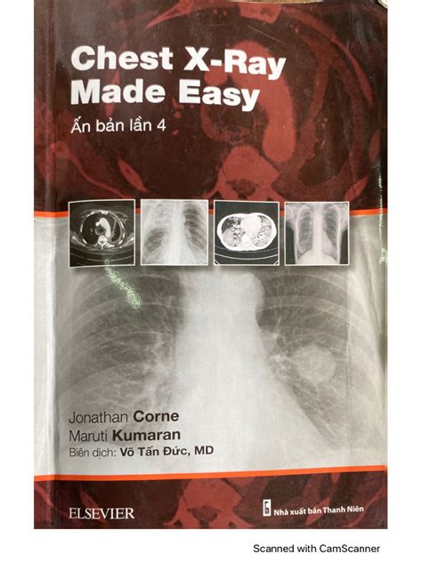 Image result for Chest X-Ray Tutorial