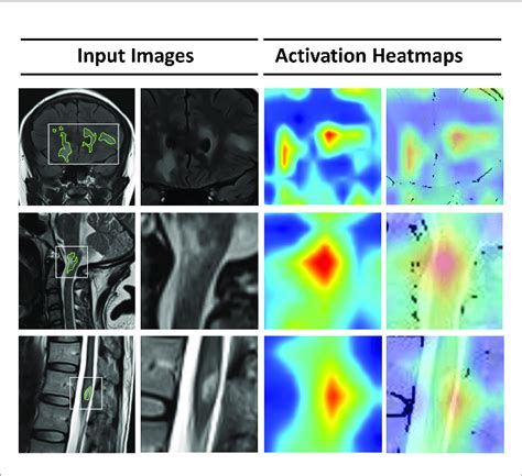 Image result for Deep Learning Features