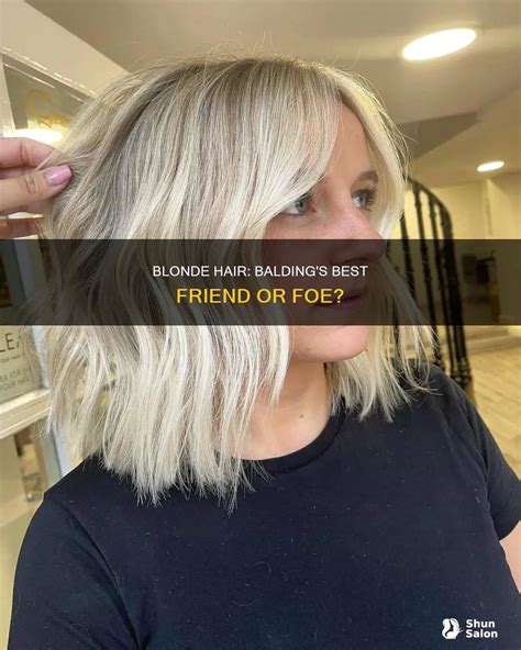 Blonde Hair: Balding's Best Friend Or Foe? | ShunSalon