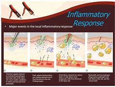 Image result for inflammatory