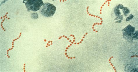 STREP 的图像结果