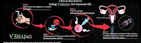 V SHAJAG Complete IUI Cannula Kit (17cm)(IUI Cannula Kit, Collection ...