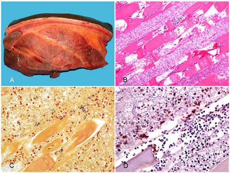 Clostridial Diseases of Horses: A Review