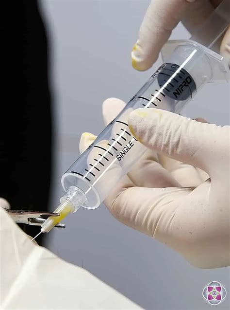 Image result for Ozone Treatment vs ClO2