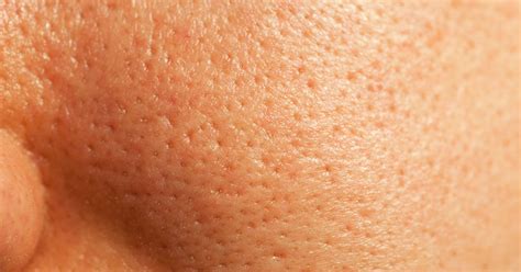 How To Minimize Pores 12 Different Ways: 10 Proven Tips to Shrink pore ...