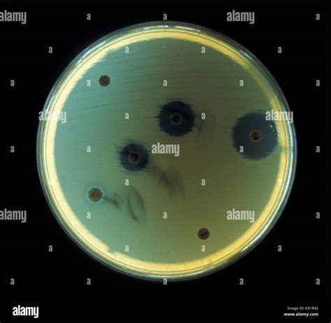 Anaerobic bacteria hi-res stock photography and images - Alamy