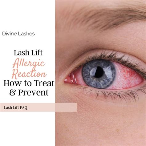 Lash Lift Aftercare: 9 Simple Rules for Long-Lasting Lashes