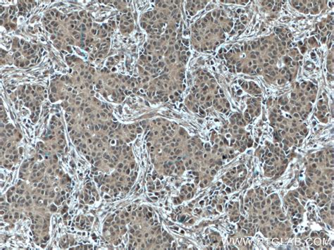 BCL2L1 antibody (66020-1-Ig) | Proteintech