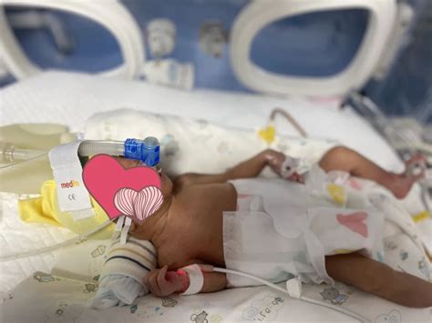 双胞胎早产男孩需六七十万医疗费 残疾父母盼援手-中青在线