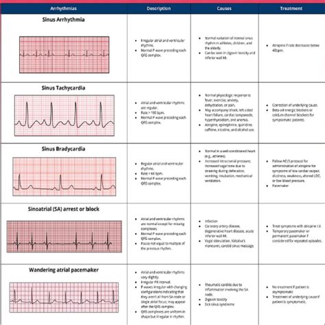 EKG Practice Course 的图像结果