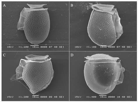 Diarrhetic Shellfish Toxins and Other Lipophilic Toxins of Human Health ...