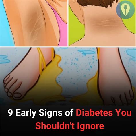 9 Early Signs of Diabetes You Shouldn't Ignore