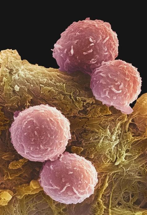 细胞扫描电镜细胞扫描电镜样品制备2022已更新今日热点