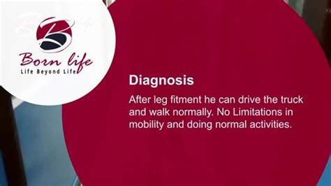 Artificial Lower Limb - Artificial Limbs for Below Knee Leg Trader ...