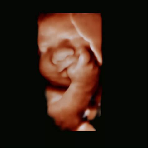 Philips - Affiniti 30 Ultrasound system