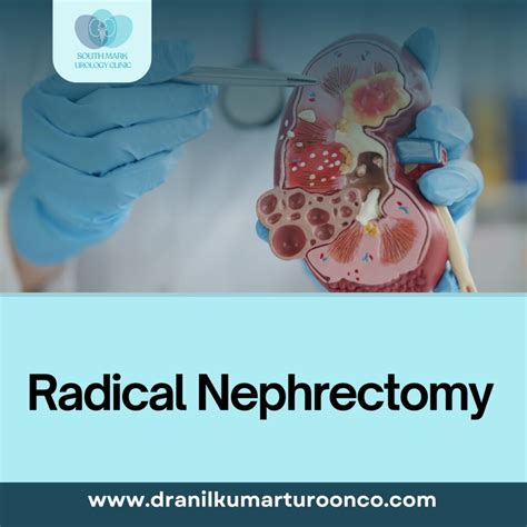 Image result for Nephrectomy Approach