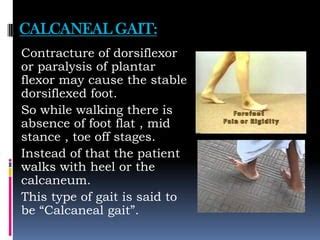 Image result for Coding Pattern Questions for Practice