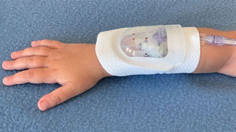 Intravenous Catheter Insertion IV Insertion YouTube