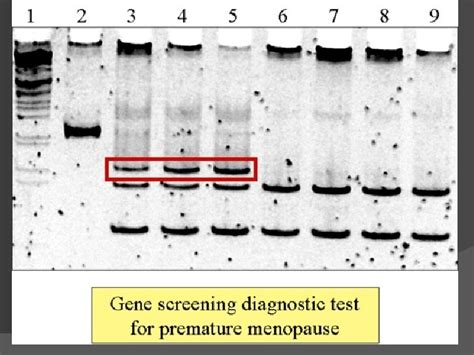 Image result for First Compound Microscope