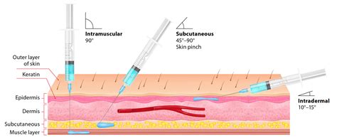 Intramuscular Injection Needle 的图像结果