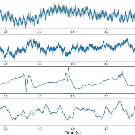 Image result for Encoder/Decoder Architecture Neural Net Image