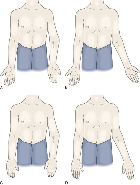 Image result for Elbow Contralateral