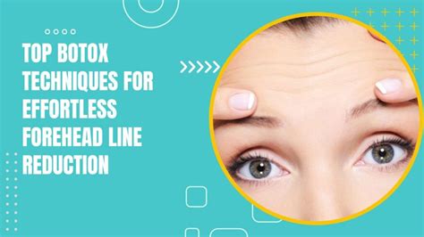 Image result for Botox Injection Pattern Forehead
