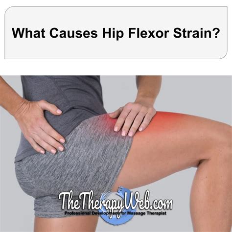 What causes hip flexor strain | TheTherapyWeb.com posted on the topic ...