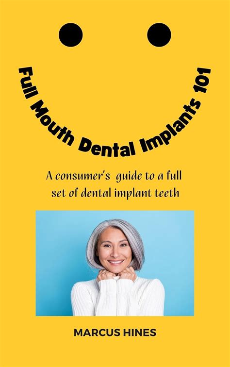 Full Mouth Dental Implants 101: A consumer's guide to a full set of ...