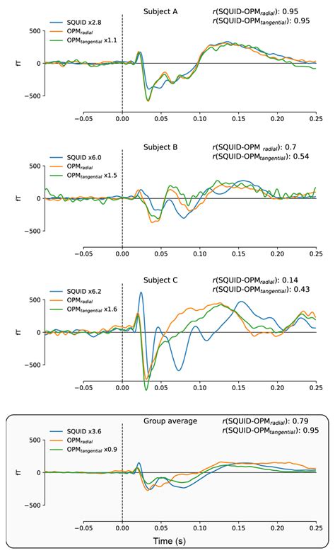 A New Generation of OPM for High Dynamic and Large Bandwidth MEG: The ...