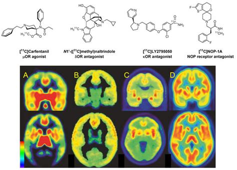 A Survey of Molecular Imaging of Opioid Receptors