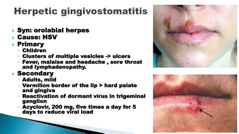 Lesions of oral cavity | PPTX