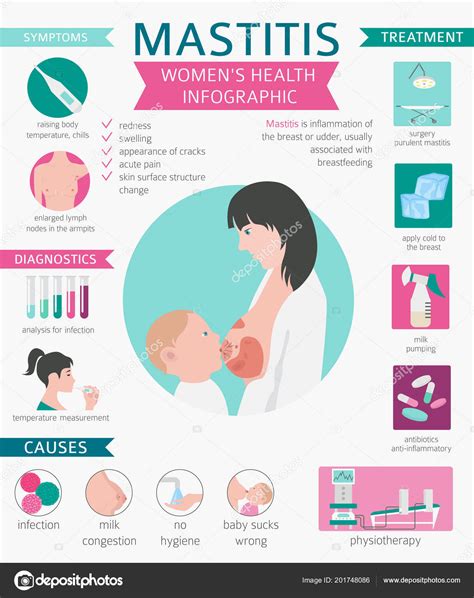 Mastitis Breastfeed Medical Infographic Diagnostics Symptoms Treatment Women Health Icon Stock ...