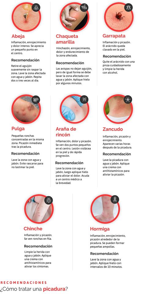 Picadura De Araña Vs Picadura De Chinche Pulga O Chinche? Conoce Las