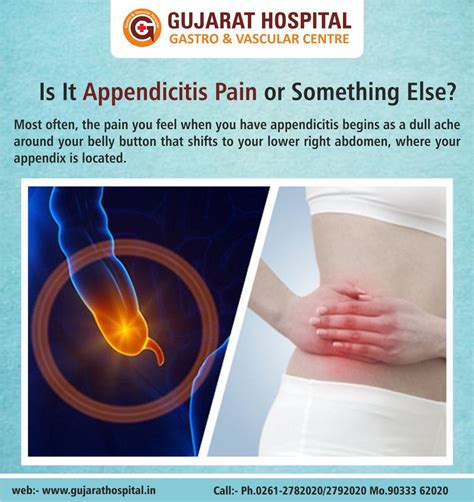 Appendicitis Pain Location