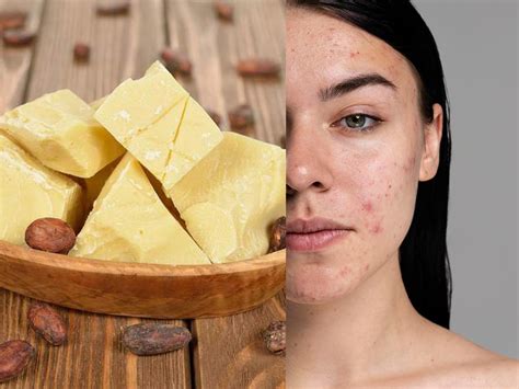 चेहरे के दाग-धब्बे हटाने के लिए 14 अति-कारगर घरेलू नुस्खे - DusBus