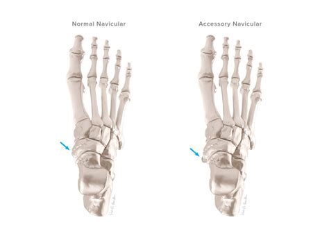 Navicular Anatomy