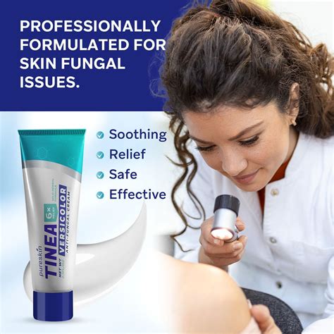 Tinea Versicolor Crema de tratamiento de hongos antifúngico para tiña versicolor tiña – Extra ...