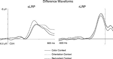 Image result for Slrp Connection